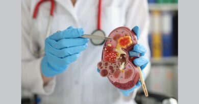 kidneycabcer